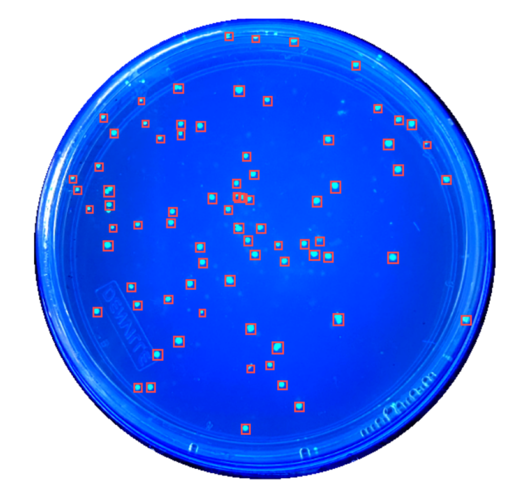 AI Agar Plate Counting Software 2025