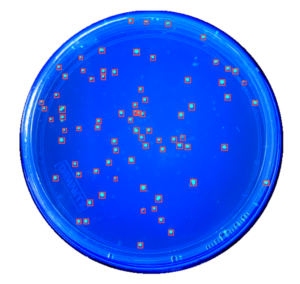 AI Agar Plate Counting Software 2025