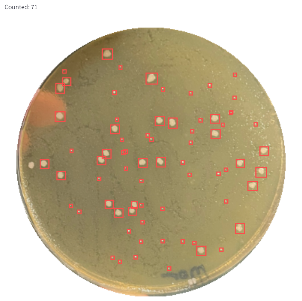 AI model to count agar plates