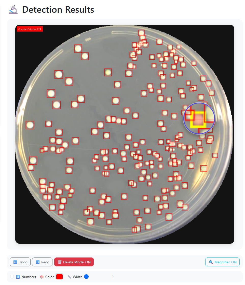 Custom laboratory counting solution preview for colony counting, cell detection, and particle analysis