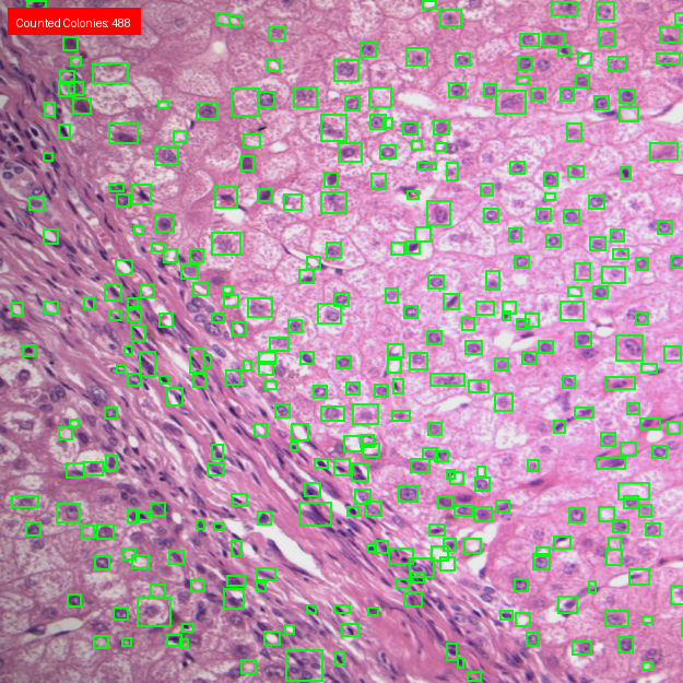 Custom laboratory counting solution preview for colony counting, cell detection, and particle analysis