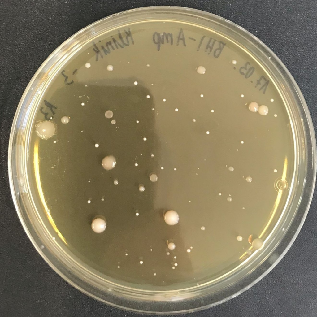 Agar plate showing individual bacterial colonies used for CFU counting
